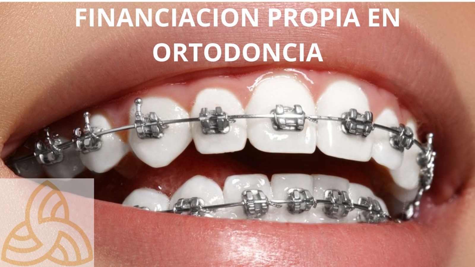 Beneficios para afiliados con optica propia